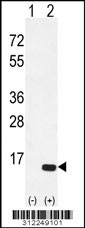 Western blot analysis of his-tag ACYP1 (arrow) using his tag antibody. 293 cell lysates (2 ug/lane) either nontransfected (Lane 1) or transiently transfected with the ACYP1 gene