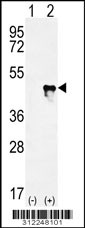 Western blot analysis of his-tag ACTG2 (arrow) using his tag antibody. 293 cell lysates (2 ug/lane) either nontransfected (Lane 1) or transiently transfected with the ACTG2 gene