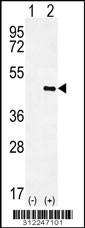 Western blot analysis of his-tag ACTA1 (arrow) using his tag antibody. 293 cell lysates (2 ug/lane) either nontransfected (Lane 1) or transiently transfected with the ACTA1 gene