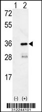 Western blot analysis of his-tag SLC25A20 (arrow) using his tag antibody. 293 cell lysates (2 ug/lane) either nontransfected (Lane 1) or transiently transfected with the SLC25A20 gene