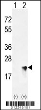 Western blot analysis of his-tag NUDT2 (arrow) using his tag antibody. 293 cell lysates (2 ug/lane) either nontransfected (Lane 1) or transiently transfected with the NUDT2 gene