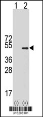 Western blot analysis of his-tag NCK2 (arrow) using his tag antibody. 293T cell lysates (2 ug/lane) either nontransfected (Lane 1) or transiently transfected with the NCK2 gene‘