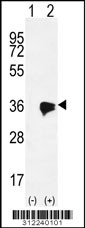 Western blot analysis of his-tag CASP6 (arrow) using his tag antibody. 293 cell lysates (2 ug/lane) either nontransfected (Lane 1) or transiently transfected with the CASP6 gene
