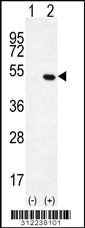 Western blot analysis of his-tag CALU (arrow) using his tag antibody. 293 cell lysates (2 ug/lane) either nontransfected (Lane 1) or transiently transfected with the CALU gene