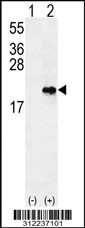 Western blot analysis of his-tag CALML3 (arrow) using his tag antibody. 293 cell lysates (2 ug/lane) either nontransfected (Lane 1) or transiently transfected with the CALML3 gene