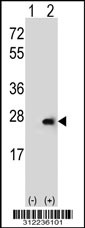 Western blot analysis of his-tag C4BPB (arrow) using his tag antibody. 293 cell lysates (2 ug/lane) either nontransfected (Lane 1) or transiently transfected with the C4BPB gene