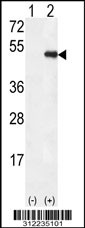 Western blot analysis of his-tag BNIP2 (arrow) using his tag antibody. 293 cell lysates (2 ug/lane) either nontransfected (Lane 1) or transiently transfected with the BNIP2 gene