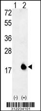 Western blot analysis of his-tag BIRC5 (arrow) using his tag antibody. 293 cell lysates (2 ug/lane) either nontransfected (Lane 1) or transiently transfected with the BIRC5 gene