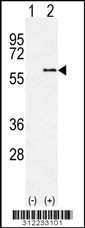 Western blot analysis of his-tag ATP6V1B2 (arrow) using his tag antibody. 293 cell lysates (2 ug/lane) either nontransfected (Lane 1) or transiently transfected with the ATP6V1B2 gene