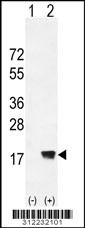 Western blot analysis of his-tag ATP6V0C (arrow) using his tag antibody. 293 cell lysates (2 ug/lane) either nontransfected (Lane 1) or transiently transfected with the ATP6V0C gene
