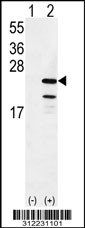 Western blot analysis of his-tag ATP5D (arrow) using his tag antibody. 293 cell lysates (2 ug/lane) either nontransfected (Lane 1) or transiently transfected with the ATP5D gene