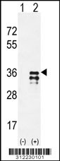 Western blot analysis of his-tag ATP1B3 (arrow) using his tag antibody. 293 cell lysates (2 ug/lane) either nontransfected (Lane 1) or transiently transfected with the ATP1B3 gene