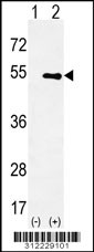 Western blot analysis of his-tag ARRB1-Ps412 (arrow) using his tag antibody. 293 cell lysates (2 ug/lane) either nontransfected (Lane 1) or transiently transfected with the ARRB1-Ps412 gene