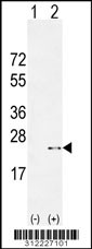 Western blot analysis of his-tag ARF4 (arrow) using his tag antibody. 293 cell lysates (2 ug/lane) either nontransfected (Lane 1) or transiently transfected with the ARF4 gene