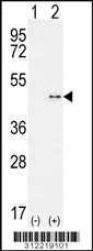 Western blot analysis of his-tag ADD1 (arrow) using his tag antibody. 293 cell lysates (2 ug/lane) either nontransfected (Lane 1) or transiently transfected with the ADD1 gene