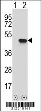 Western blot analysis of his-tag ACY1 (arrow) using his tag antibody. 293 cell lysates (2 ug/lane) either nontransfected (Lane 1) or transiently transfected with the ACY1 gene