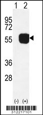 Western blot analysis of his-tag ABAT (arrow) using his tag antibody. 293 cell lysates (2 ug/lane) either nontransfected (Lane 1) or transiently transfected with the ABAT gene