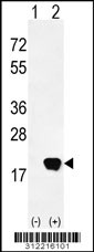Western blot analysis of his-tag SUMO4 (arrow) using his tag antibody. 293 cell lysates (2 ug/lane) either nontransfected (Lane 1) or transiently transfected with the SUMO4 gene