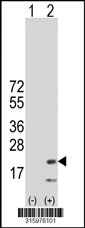 Western blot analysis of his-tag GOLT1A (arrow) using his tag antibody. 293T cell lysates (2 ug/lane) either nontransfected (Lane 1) or transiently transfected with the GOLT1A gene‘