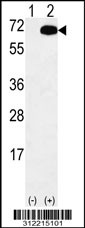 Western blot analysis of his-tag SNCAIP (arrow) using his tag antibody. 293 cell lysates (2 ug/lane) either nontransfected (Lane 1) or transiently transfected with the SNCAIP gene