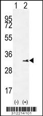 Western blot analysis of his-tag SLC25A6 (arrow) using his tag antibody. 293 cell lysates (2 ug/lane) either nontransfected (Lane 1) or transiently transfected with the SLC25A6 gene