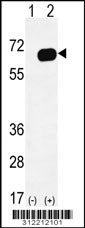 Western blot analysis of his-tag SERPING1 (arrow) using his tag antibody. 293 cell lysates (2 ug/lane) either nontransfected (Lane 1) or transiently transfected with the SERPING1 gene