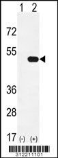 Western blot analysis of his-tag RBBP7 (arrow) using his tag antibody. 293 cell lysates (2 ug/lane) either nontransfected (Lane 1) or transiently transfected with the RBBP7 gene
