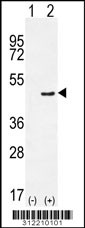 Western blot analysis of his-tag PRMT1 (arrow) using his tag antibody. 293 cell lysates (2 ug/lane) either nontransfected (Lane 1) or transiently transfected with the PRMT1 gene