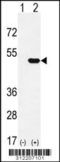 Western blot analysis of his-tag NUP50 (arrow) using his tag antibody. 293 cell lysates (2 ug/lane) either nontransfected (Lane 1) or transiently transfected with the NUP50 gene