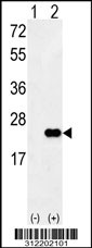 Western blot analysis of his-tag BAD (arrow) using his tag antibody. 293 cell lysates (2 ug/lane) either nontransfected (Lane 1) or transiently transfected with the BAD gene