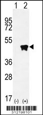 Western blot analysis of his-tag CAPG (arrow) using his tag antibody. 293 cell lysates (2 ug/lane) either nontransfected (Lane 1) or transiently transfected with the CAPG gene