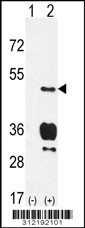 Western blot analysis of his-tag BLMH (arrow) using his tag antibody. 293 cell lysates (2 ug/lane) either nontransfected (Lane 1) or transiently transfected with the BLMH gene