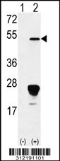 Western blot analysis of his-tag BAAT (arrow) using his tag antibody. 293 cell lysates (2 ug/lane) either nontransfected (Lane 1) or transiently transfected with the BAAT gene