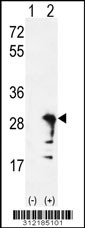 Western blot analysis of his-tag AQP1 (arrow) using his tag antibody. 293 cell lysates (2 ug/lane) either nontransfected (Lane 1) or transiently transfected with the AQP1 gene