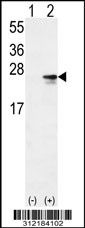 Western blot analysis of his-tag APOBEC3A (arrow) using his tag antibody. 293 cell lysates (2 ug/lane) either nontransfected (Lane 1) or transiently transfected with the APOBEC3A gene