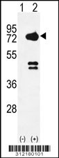 Western blot analysis of his-tag ADD2 (arrow) using his tag antibody. 293 cell lysates (2 ug/lane) either nontransfected (Lane 1) or transiently transfected with the ADD2 gene
