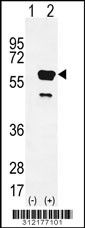 Western blot analysis of his-tag PRODH (arrow) using his tag antibody. 293 cell lysates (2 ug/lane) either nontransfected (Lane 1) or transiently transfected with the PRODH gene