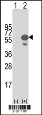 Western blot analysis of his-tag UGT1A1 (arrow) using his tag antibody. 293T cell lysates (2 ug/lane) either nontransfected (Lane 1) or transiently transfected with the UGT1A1 gene‘