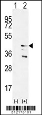 Western blot analysis of his-tag GJC1 (arrow) using his tag antibody. 293 cell lysates (2 ug/lane) either nontransfected (Lane 1) or transiently transfected with the GJC1 gene