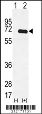 Western blot analysis of his-tag DOK1 (arrow) using his tag antibody. 293 cell lysates (2 ug/lane) either nontransfected (Lane 1) or transiently transfected with the DOK1 gene
