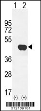 Western blot analysis of his-tag DAPK2 (arrow) using his tag antibody. 293 cell lysates (2 ug/lane) either nontransfected (Lane 1) or transiently transfected with the DAPK2 gene