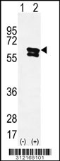Western blot analysis of his-tag CNDP1 (arrow) using his tag antibody. 293 cell lysates (2 ug/lane) either nontransfected (Lane 1) or transiently transfected with the CNDP1 gene