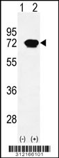 Western blot analysis of his-tag ALPI (arrow) using his tag antibody. 293 cell lysates (2 ug/lane) either nontransfected (Lane 1) or transiently transfected with the ALPI gene