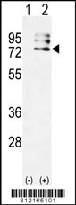 Western blot analysis of his-tag ALOX5 (arrow) using his tag antibody. 293 cell lysates (2 ug/lane) either nontransfected (Lane 1) or transiently transfected with the ALOX5 gene