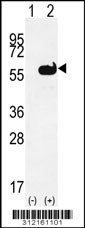 Western blot analysis of his-tag TPH2 (arrow) using his tag antibody. 293 cell lysates (2 ug/lane) either nontransfected (Lane 1) or transiently transfected with the TPH2 gene