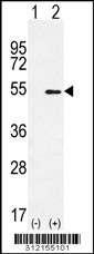 Western blot analysis of his-tag OLFML1 (arrow) using his tag antibody. 293 cell lysates (2 ug/lane) either nontransfected (Lane 1) or transiently transfected with the OLFML1 gene