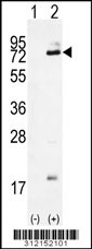 Western blot analysis of his-tag NGLY1 (arrow) using his tag antibody. 293 cell lysates (2 ug/lane) either nontransfected (Lane 1) or transiently transfected with the NGLY1 gene
