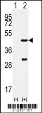 Western blot analysis of his-tag NCF4 (arrow) using his tag antibody. 293 cell lysates (2 ug/lane) either nontransfected (Lane 1) or transiently transfected with the NCF4 gene