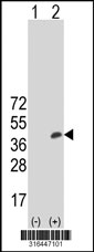 Western blot analysis of his-tag B3GAT2 (arrow) using his tag antibody. 293T cell lysates (2 ug/lane) either nontransfected (Lane 1) or transiently transfected with the B3GAT2 gene‘
