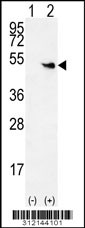 Western blot analysis of his-tag KRT83 (arrow) using his tag antibody. 293 cell lysates (2 ug/lane) either nontransfected (Lane 1) or transiently transfected with the KRT83 gene